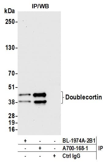 Anti-Doublecortin antibody [BLR168J] - BSA free(AB314076)