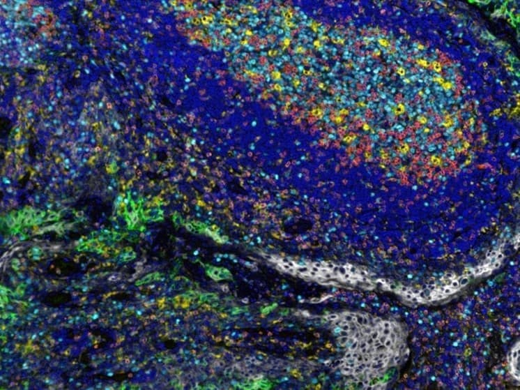 Anti-CD3 epsilon antibody [SP7] - BSA and Azide free(AB205228)