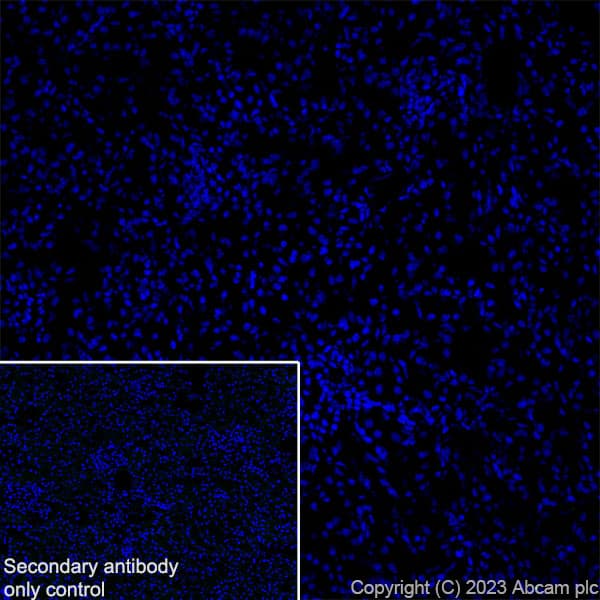Anti-RS1 antibody [EPR28513-78](AB314231)