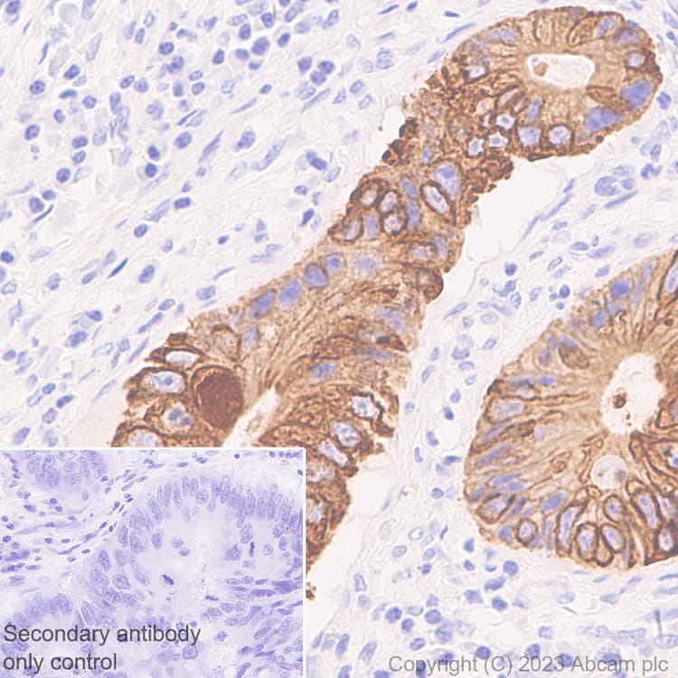 Pan Cytokeratin Antibody Epr28285 45 Bsa And Azide Free Ab308263  Immunohistochemistry Formalin Pfa Fixed Paraffin Embedded Sections Img408893
