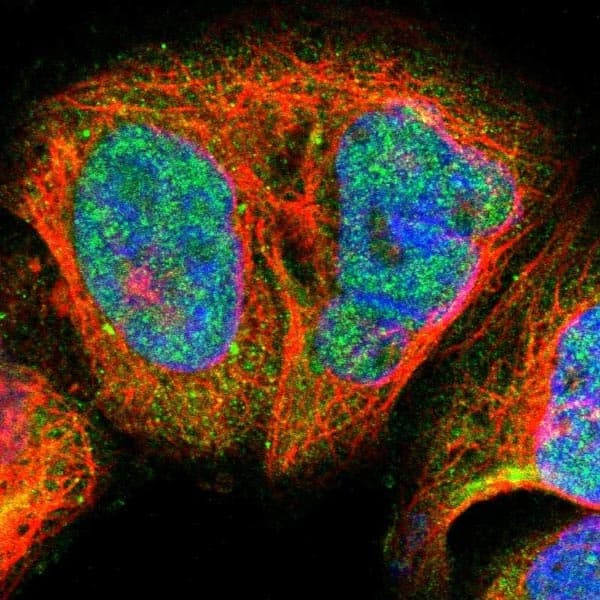 Anti-Blooms Syndrome Protein Blm antibody(AB223734)