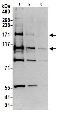 Anti-TRPM2 antibody(AB11168)