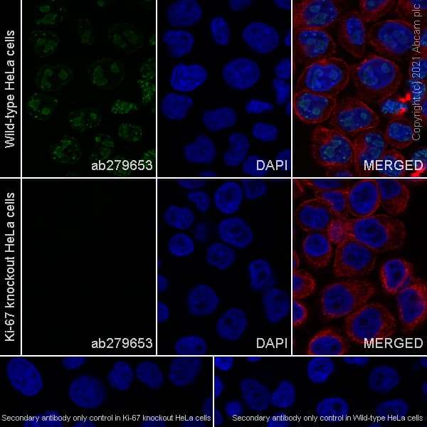 Anti-Ki67 antibody [B56](AB279653)
