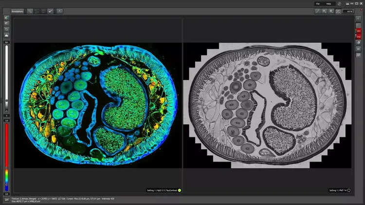 Identification Of Distinct Structures In A Transverse Section Of Roundworm