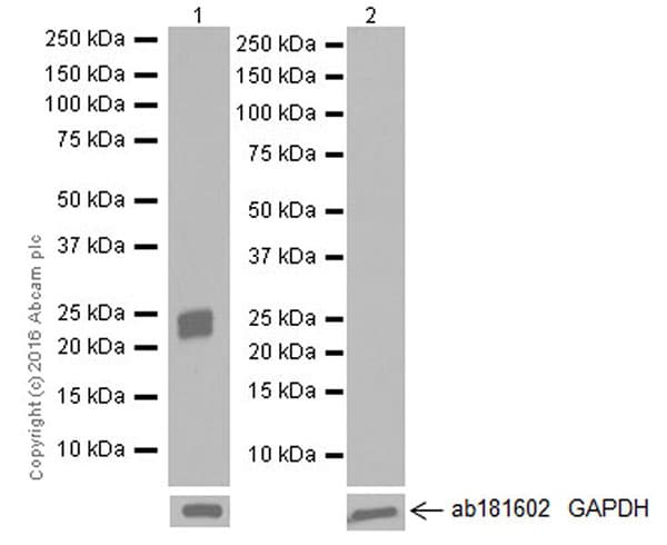 Anti-Prosurfactant Protein C antibody [EPR19839](AB211326)