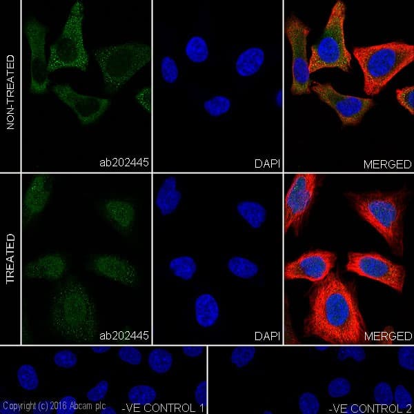 Anti-Smad2 + Smad3 antibody [EPR19557-4] - ChIP Grade(AB202445)