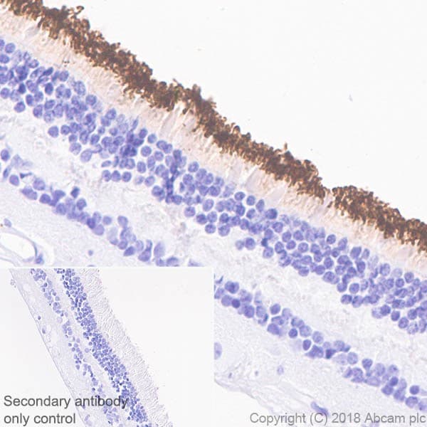 Anti-Rhodopsin antibody [EPR21876](AB221664)