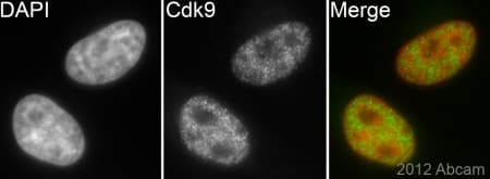 Anti-Cdk9 antibody [EPR3119Y](AB76320)