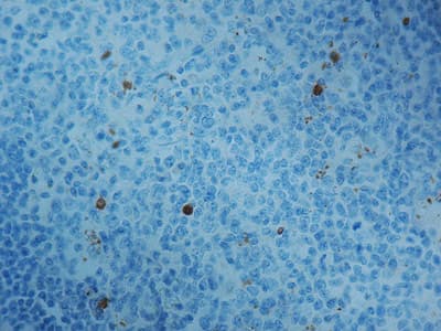 Anti-Caspase-3 antibody(AB4051)