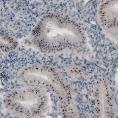 Anti-NIFK antibody [CL2240] - Nucleolar Marker(AB211871)
