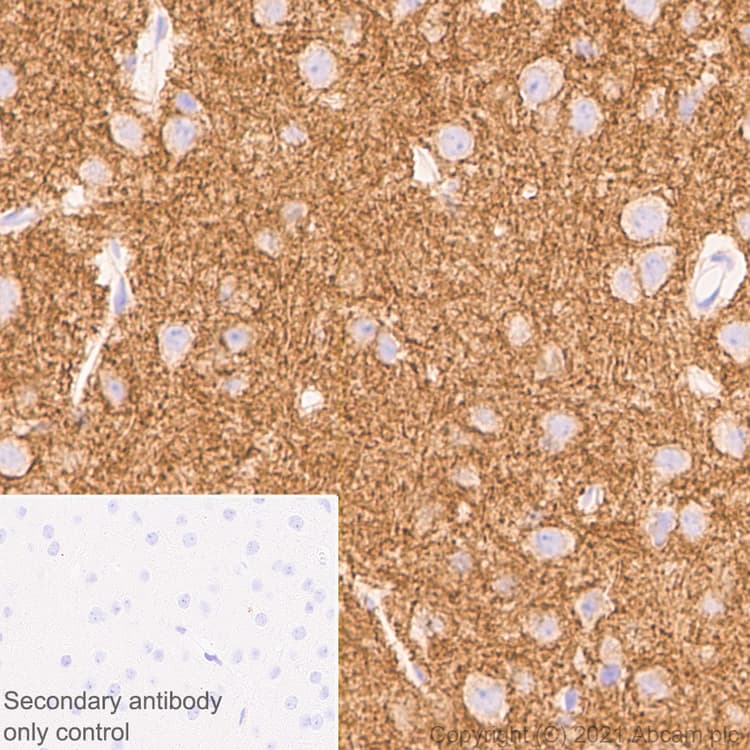 Anti-KCC2 antibody [EPR24203-85](AB259969)