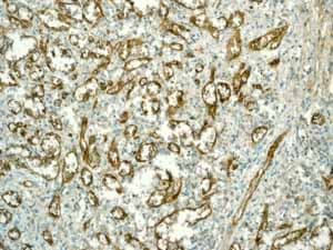 Anti-CD146 antibody [EPR3208](ab75769)