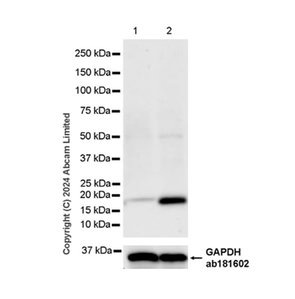 Anti-CXCL9 antibody [EPR28968-26](AB320827)