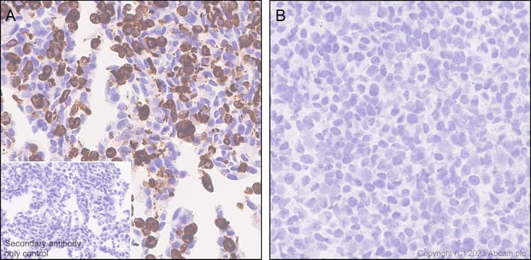 Anti-GPCR GPR17 antibody [EPR26423-34](AB316105)