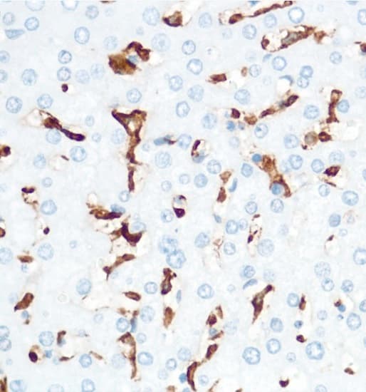 Macrophage Marker (CD11b, CD68, CD163, CD14, CD16) Antibody Panel - Human(AB254013)