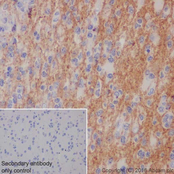 Anti-Alpha-synuclein antibody [EPR20535] - BSA and Azide free(AB225866)