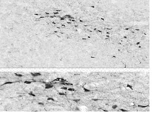 Anti-Tyrosine Hydroxylase antibody(AB6211)