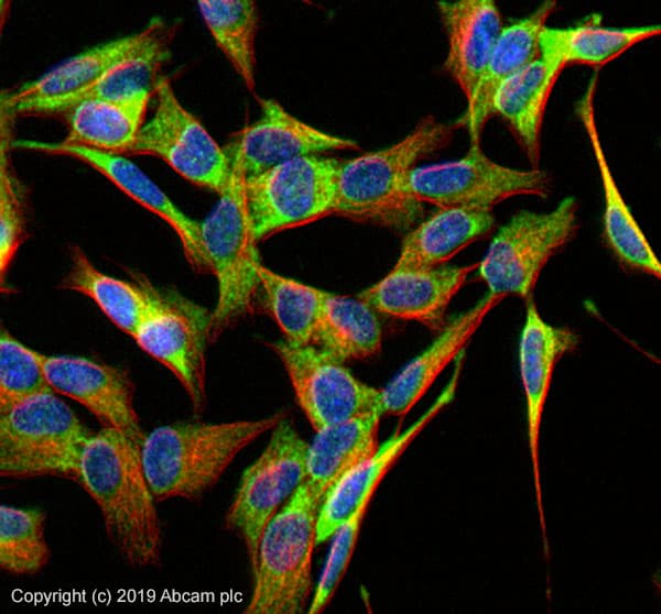 Anti-PSD95 antibody - Synaptic Marker(AB18258)