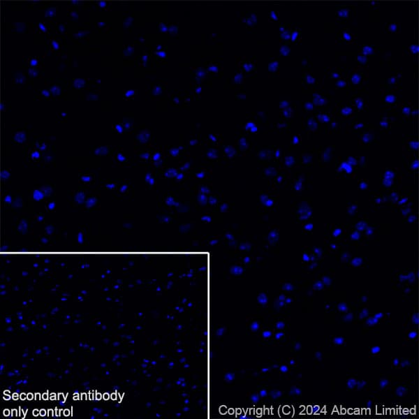 Anti-Prosurfactant Protein C antibody [RM1264](AB322443)