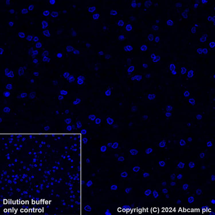 Alexa Fluor 647 Cytokeratin 5 Antibody Ep1601y Ab193895  Immunohistochemistry Formalin Pfa Fixed Paraffin Embedded Sections Img448924