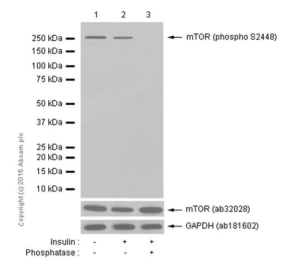 Anti-mTOR (phospho S2448) antibody [EPR426(2)](AB109268)