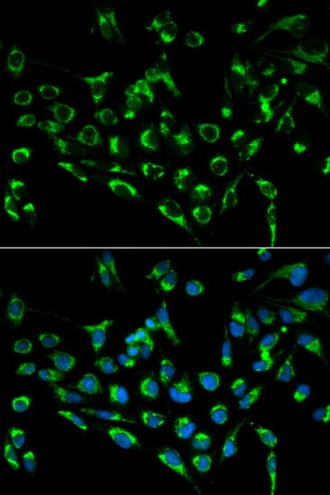 Cdkn3 Antibody Ab175393  Immunocytochemistry Immunofluorescence Img68736