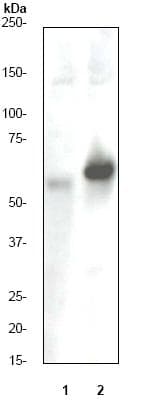 Estrogen Receptor Alpha Phospho S118 Antibody E91 Ab32396  Western Blot Img135629