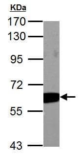 Pkm Antibody Ab137852  Western Blot Img47913