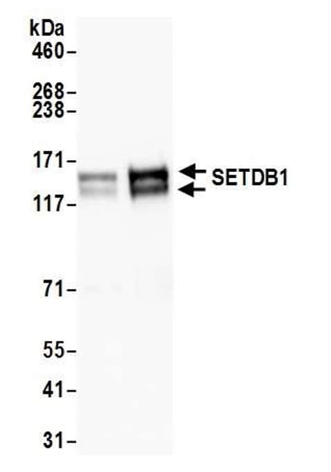 Anti-KMT1E / SETDB1 antibody(AB12317)