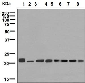 Anti-RAB7 antibody [EPR7589](AB137029)