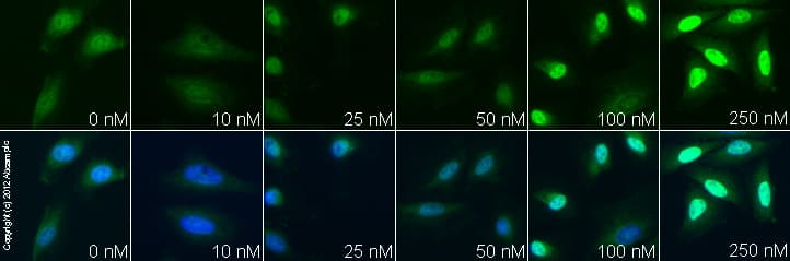 Dexamethasone, anti-inflammatory glucocorticoid(AB120743)