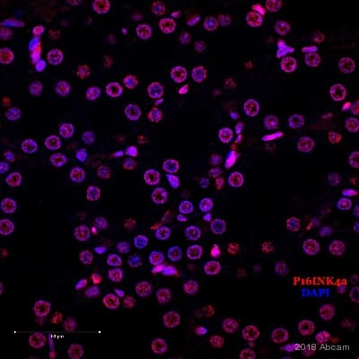 Anti-CDKN2A/p16INK4a antibody [2D9A12](AB54210)