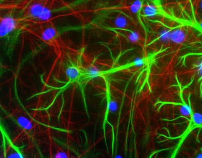Anti-GFAP antibody [2A5](AB4648)