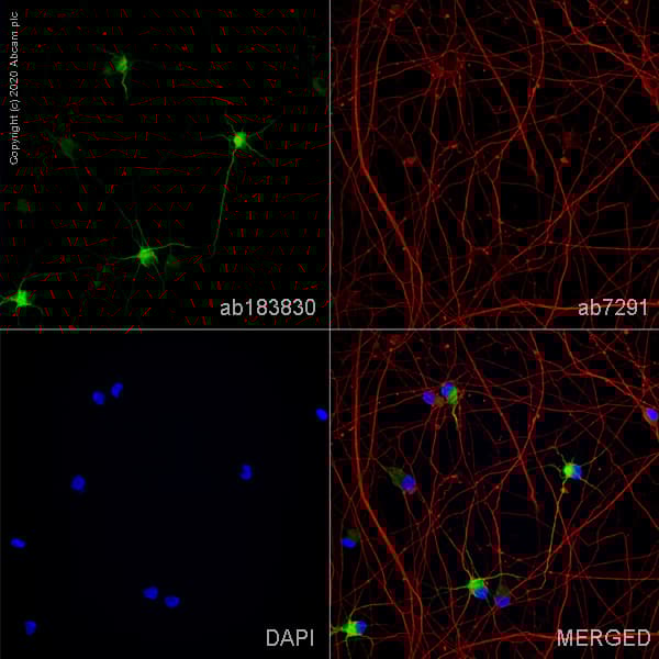 Anti-MAP2 antibody [EPR19691](AB183830)