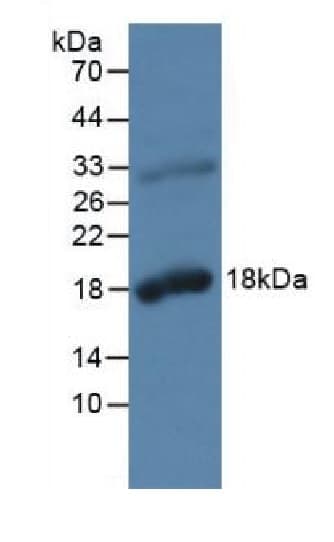Anti-Kallikrein 2/KLK2 antibody(ab232980)