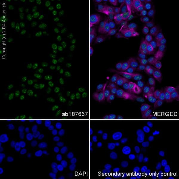 Anti-ROR beta/RORB antibody [EPR15552] - N-terminal(AB187657)