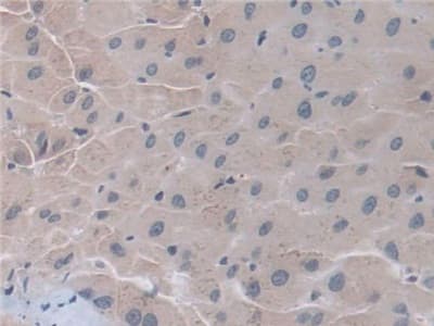 Anti-D2HGDH antibody(AB233516)