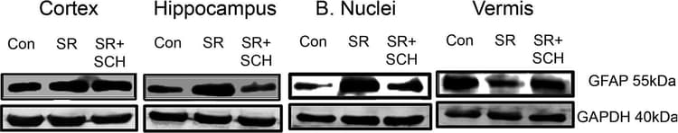 Anti-GFAP antibody [2A5](AB4648)