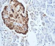 Anti-Glucagon antibody [EP3070](AB92517)