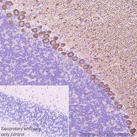 Anti-IP3 receptor antibody [EPR4537](AB108517)