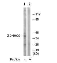 Zdhhc9 Antibody Ab74504  Western Blot Img6947