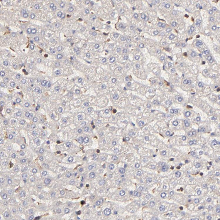 Ston2 Antibody Ab121165  Immunohistochemistry Formalin Pfa Fixed Paraffin Embedded Sections Img18490