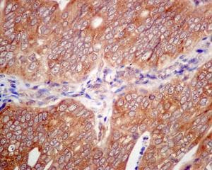 Lsm12 Antibody Epr12282 87 Ab173292  Immunohistochemistry Formalin Pfa Fixed Paraffin Embedded Sections Img68142