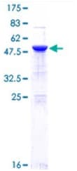 Recombinant Human NF-kB p65 protein (Tagged)(AB114150)