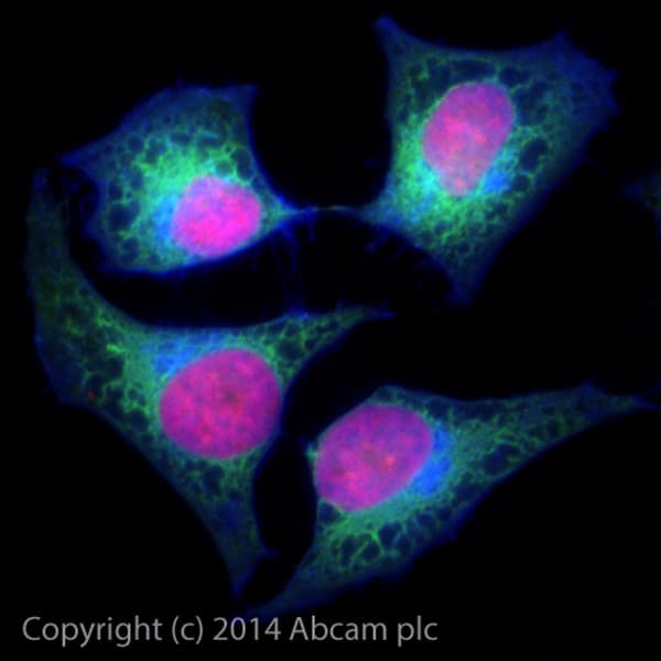 Alexa Fluor® 488 Anti-Cytokeratin 7 antibody [EPR1619Y] - Cytoskeleton Marker(AB185048)
