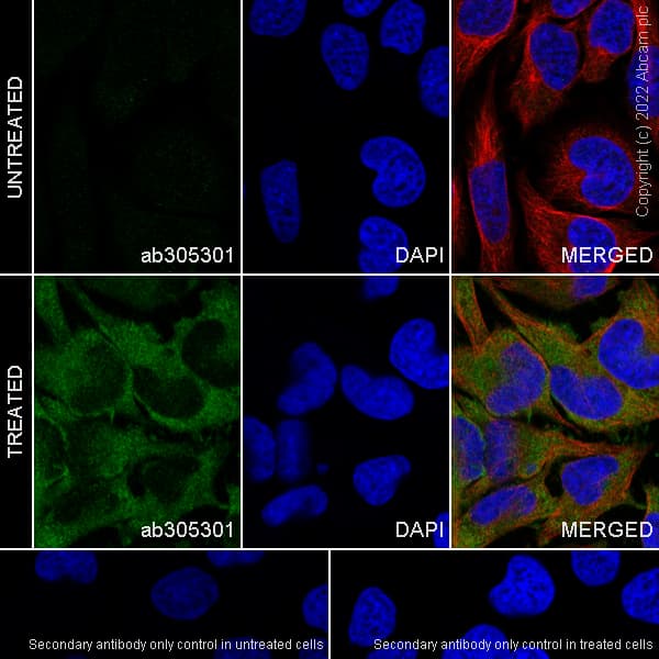 Ifit1 Antibody Epr27276 63 Bsa And Azide Free Ab305302  Immunocytochemistry Immunofluorescence Img405042