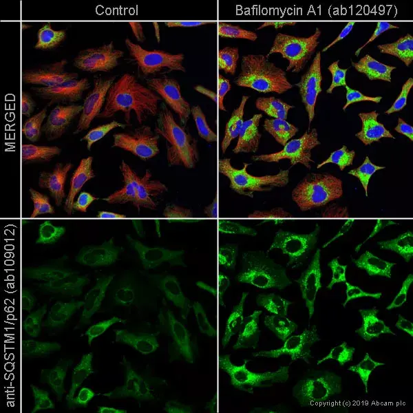 Anti-SQSTM1 / p62 antibody [EPR4844] - Autophagosome Marker(AB109012)