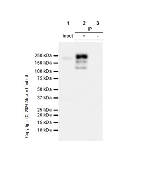 Dnmt1 Antibody Rm1192 Ab317845  Immunoprecipitation Img434521