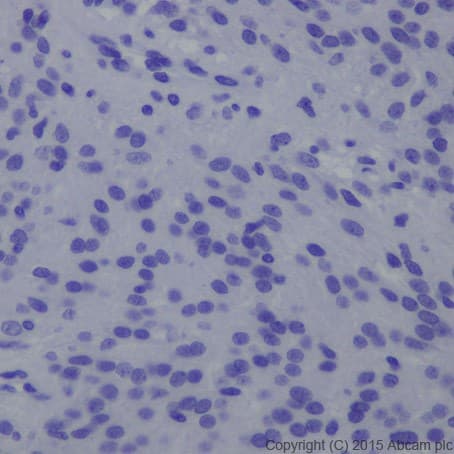 Anti-Brachyury / Bry antibody [EPR18113](AB209665)