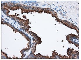 Pank2 Antibody Oti3h9 Ab119070  Immunohistochemistry Formalin Pfa Fixed Paraffin Embedded Sections Img96662